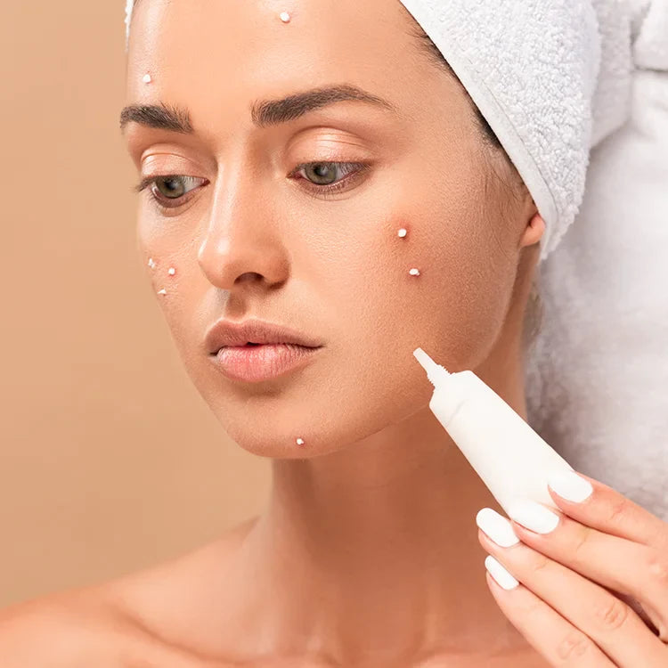 Acne Treatments & Kits